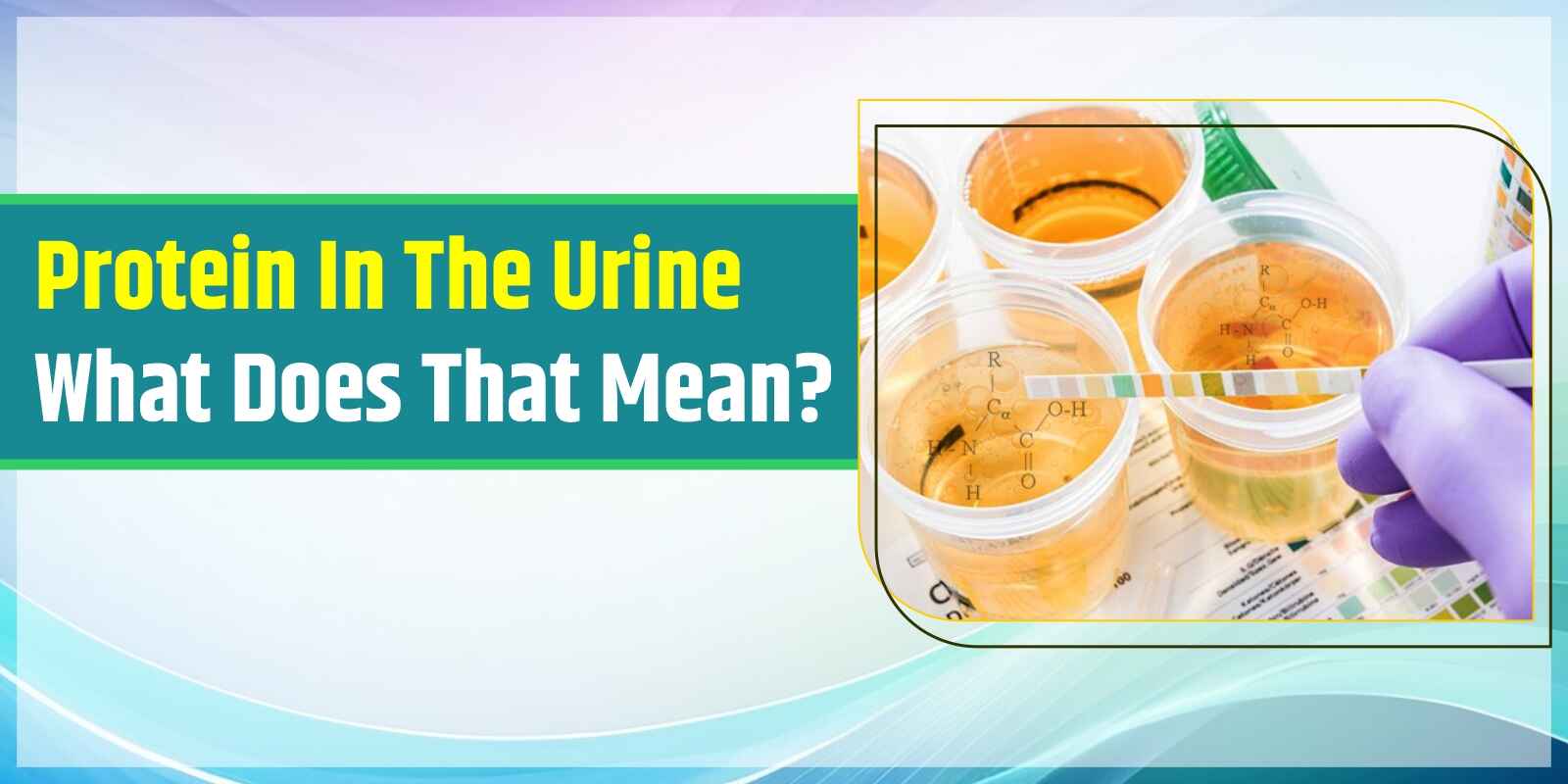 Protein In The Urine What Does That Mean?